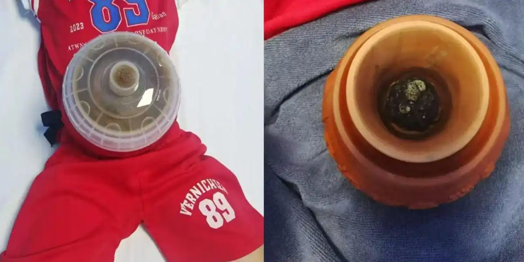 未病先防 中医智慧，新医大五附院针灸科开展“脐疗”法